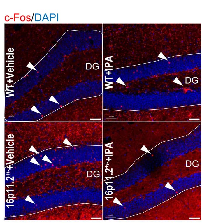 Open access visualization of Microscopy, c-Fos, Neurons, Hippocampus
