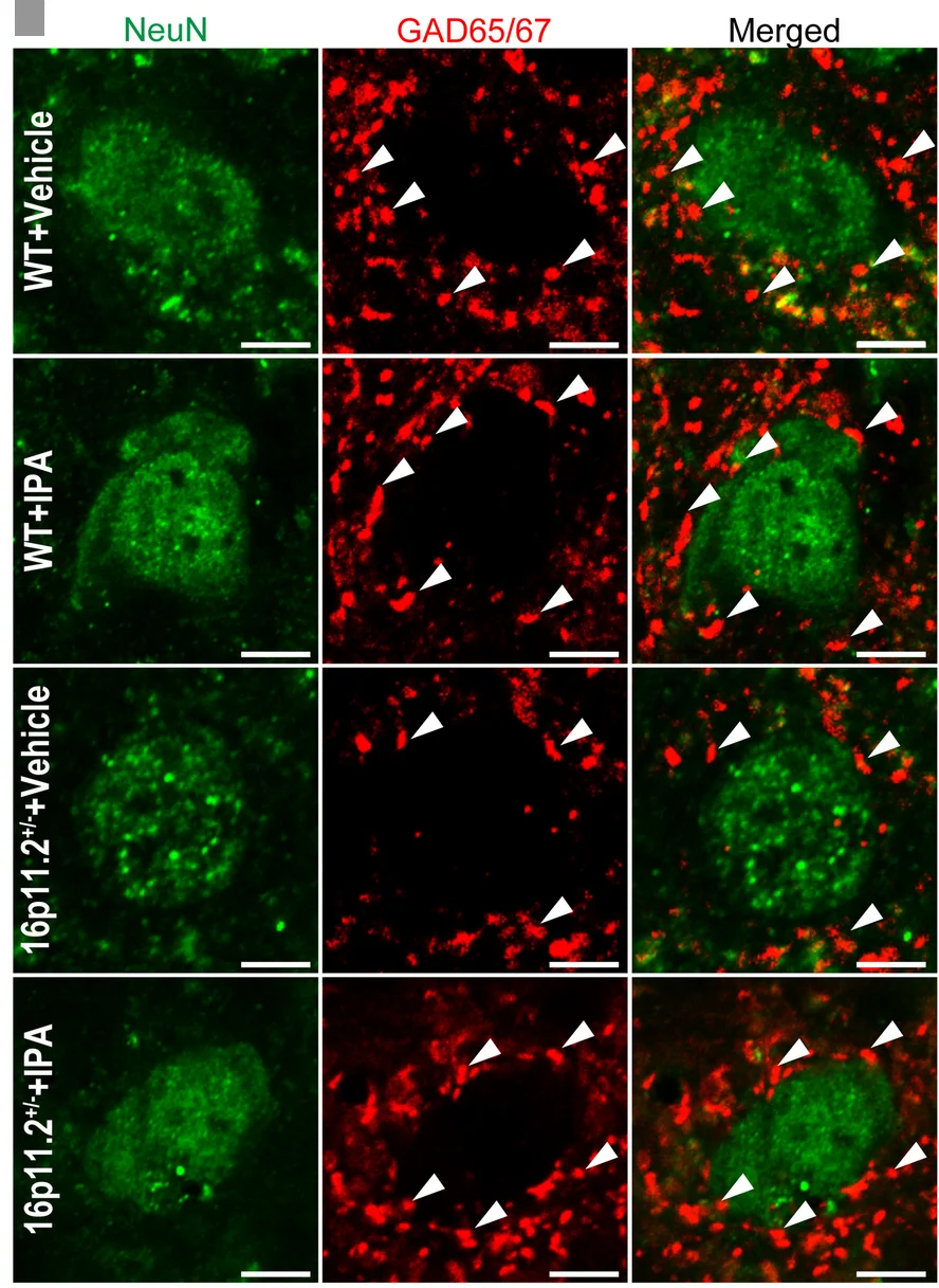 Open access visualization of Microscopy, Confocal Planes, GAD65/67, Neurons, Hippocampus