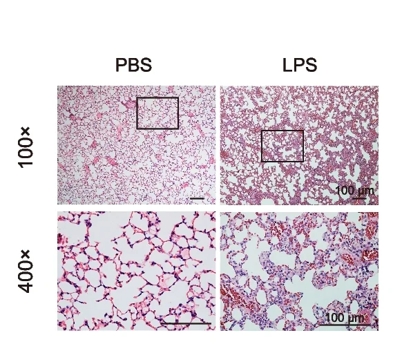 Open access visualization of Microscopy, H&E Staining, Lung Tissue, LPS, PBS