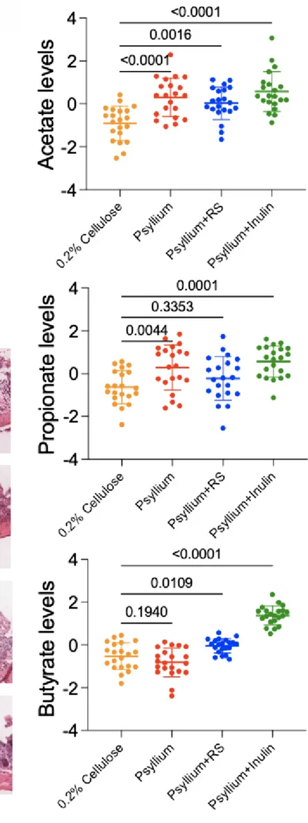 Open access visualization of Scatter Plot, Error Bars, Caecal SCFAs, Non-Tumor-Bearing Mice, Modified Diet