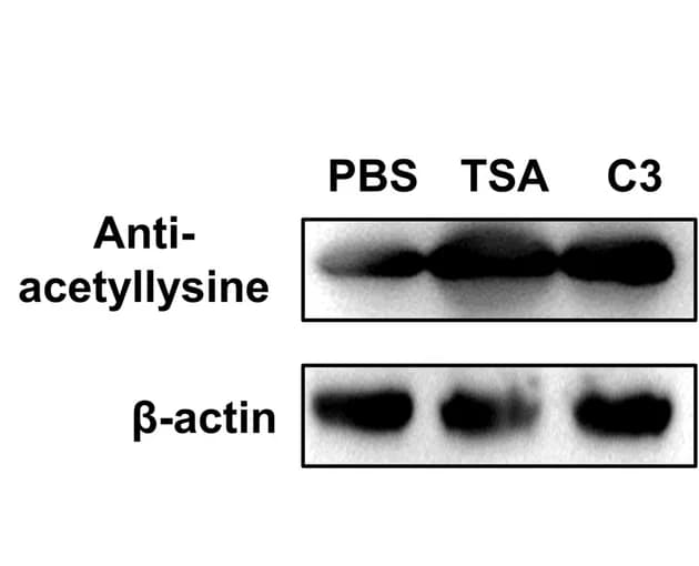Open access visualization of Gel, CD4+ T Cells, C3 Treatment, Protein Acetylation, Th17 Cells