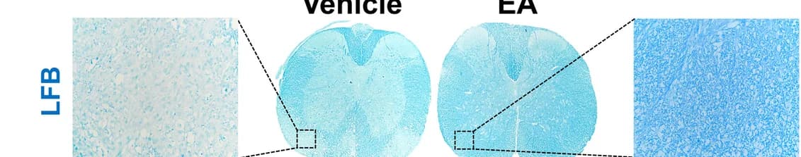 Open access visualization of Microscopy, EAE Mice, Spinal Cord, Luxol Fast Blue, Hematoxylin and Eosin