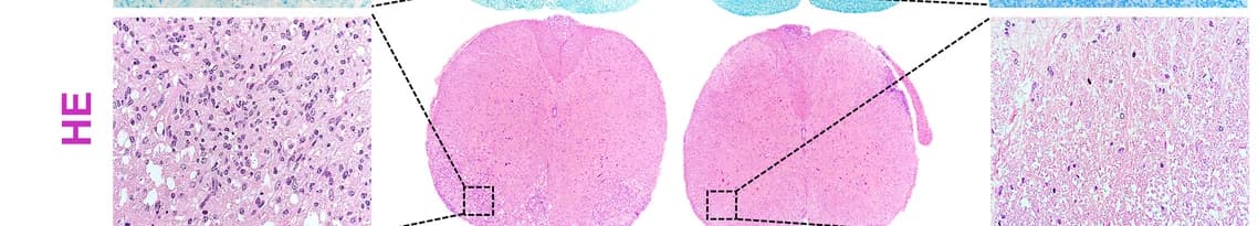 Open access visualization of Microscopy, Photo, EAE Mice, Spinal Cord, Luxol Fast Blue