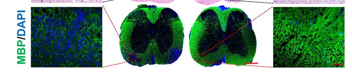 Open access visualization of Microscopy, EAE Mice, Spinal Cord, Luxol Fast Blue, Hematoxylin and Eosin