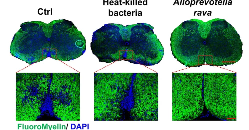 Open access visualization of Microscopy, Immunofluorescence, Myelin Sheaths, Spinal Cord, EAE Mice