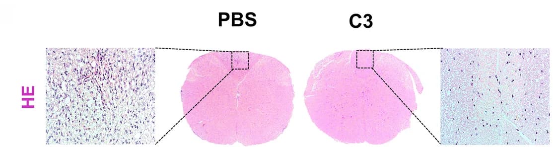 Open access visualization of Microscopy, Spinal Cord Sections, Luxol Fast Blue, Demyelination