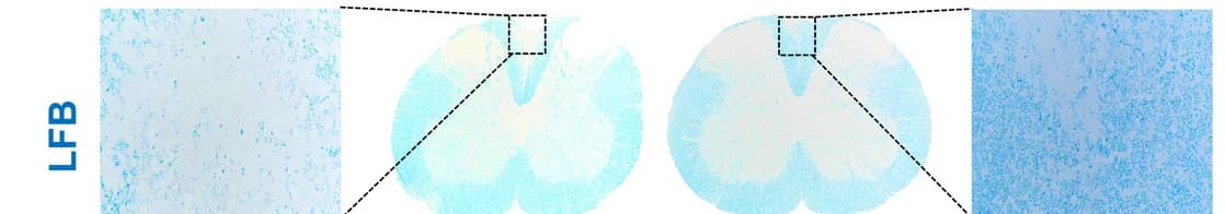 Open access visualization of Microscopy, Spinal Cord Sections, Haematoxylin and Eosin, Inflammation