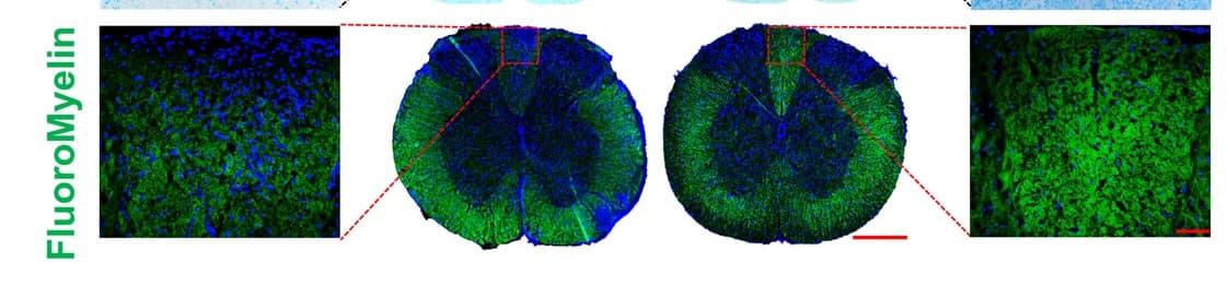 Open access visualization of Microscopy, Spinal Cord Sections, Immunofluorescent Staining, Myelin Sheaths