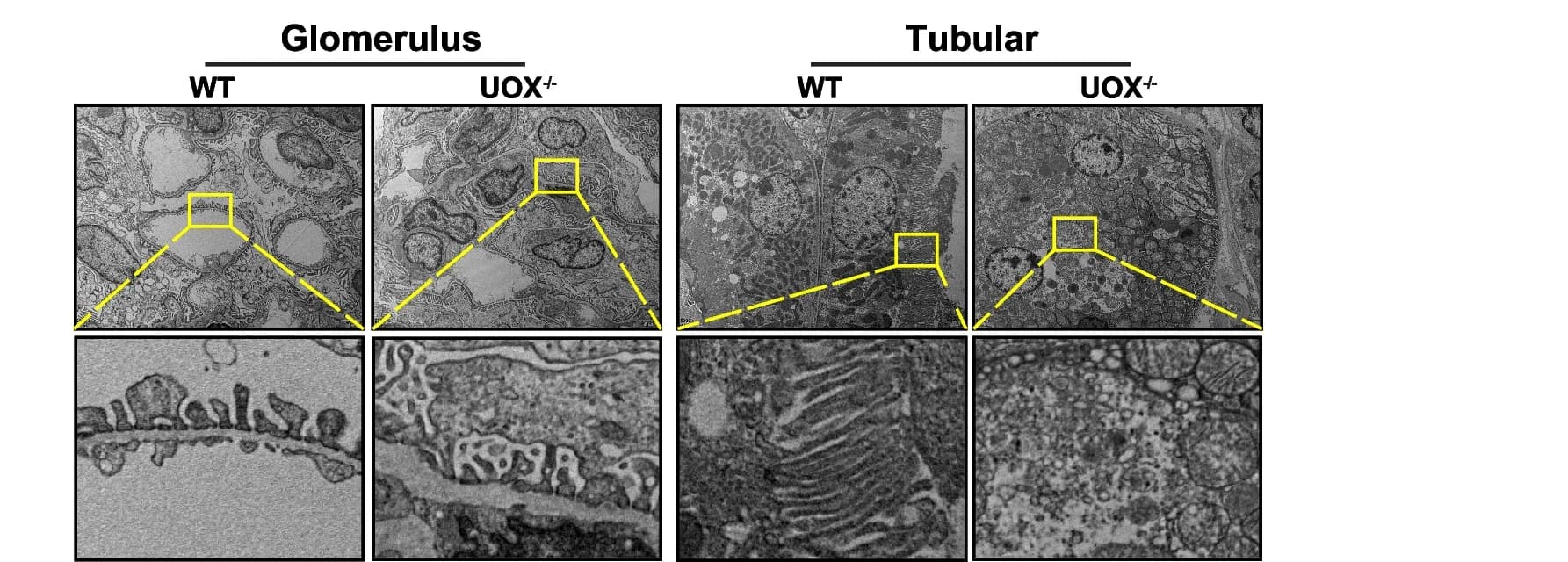 Open access visualization of Microscopy, TEM, Kidneys