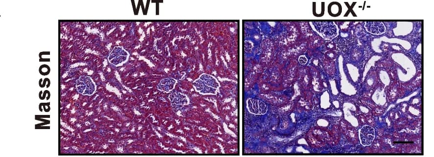 Open access visualization of Microscopy, Masson Trichrome Staining, Fibrotic Areas