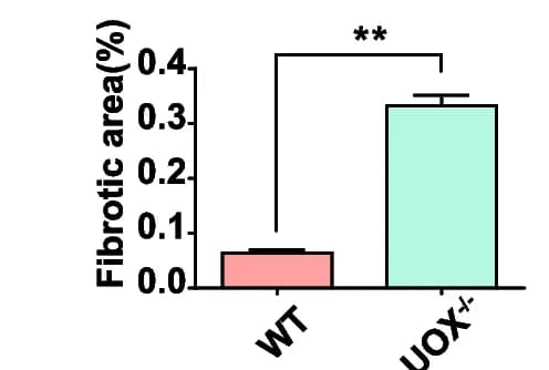 Open access visualization of Bar Plot, Error Bars, Masson Trichrome Staining, Fibrotic Areas