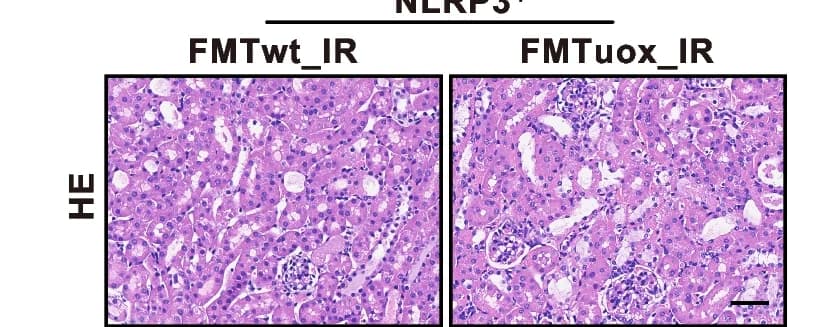 Open access visualization of Microscopy, Hematoxylin and Eosin Staining, Kidneys, Recipient Mice, Histopathology