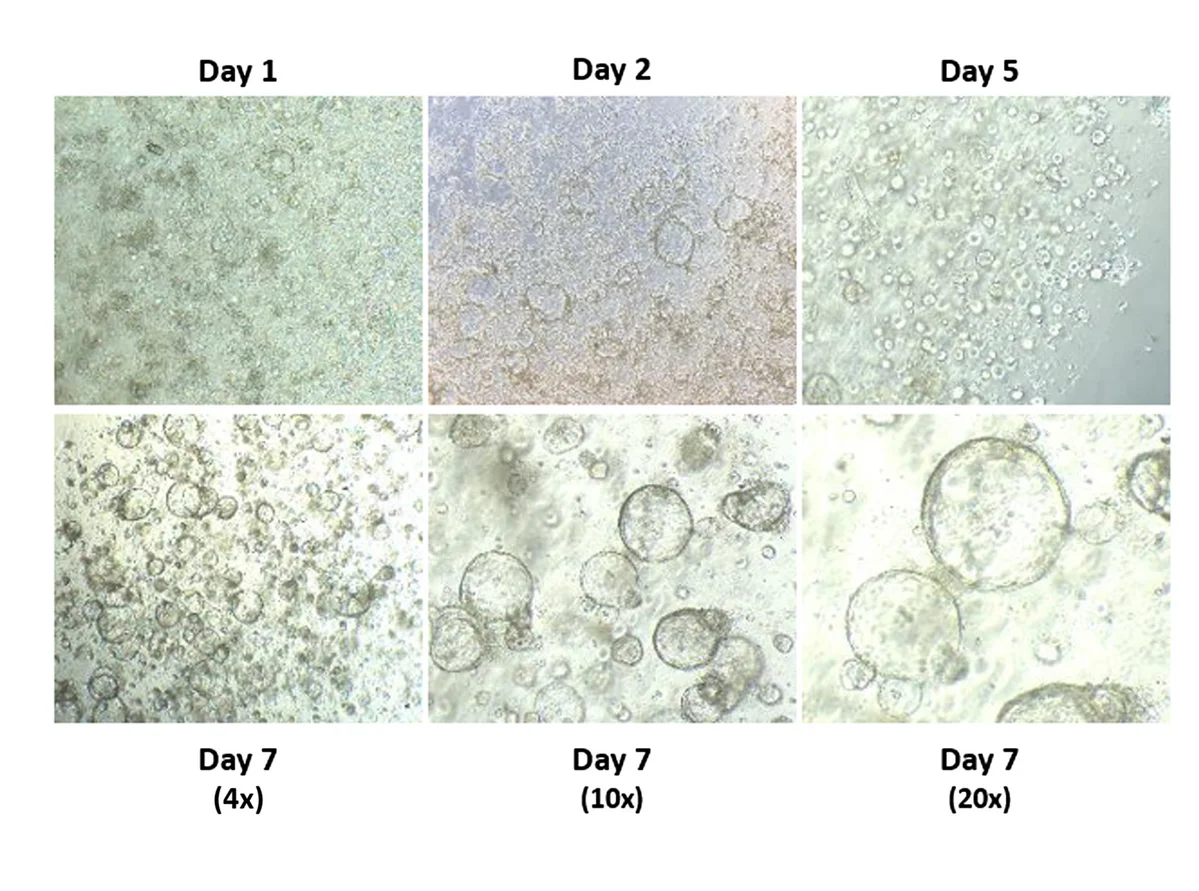 Open access visualization of Microscopy, PNOs, Morphology, Bright Field Microscopy