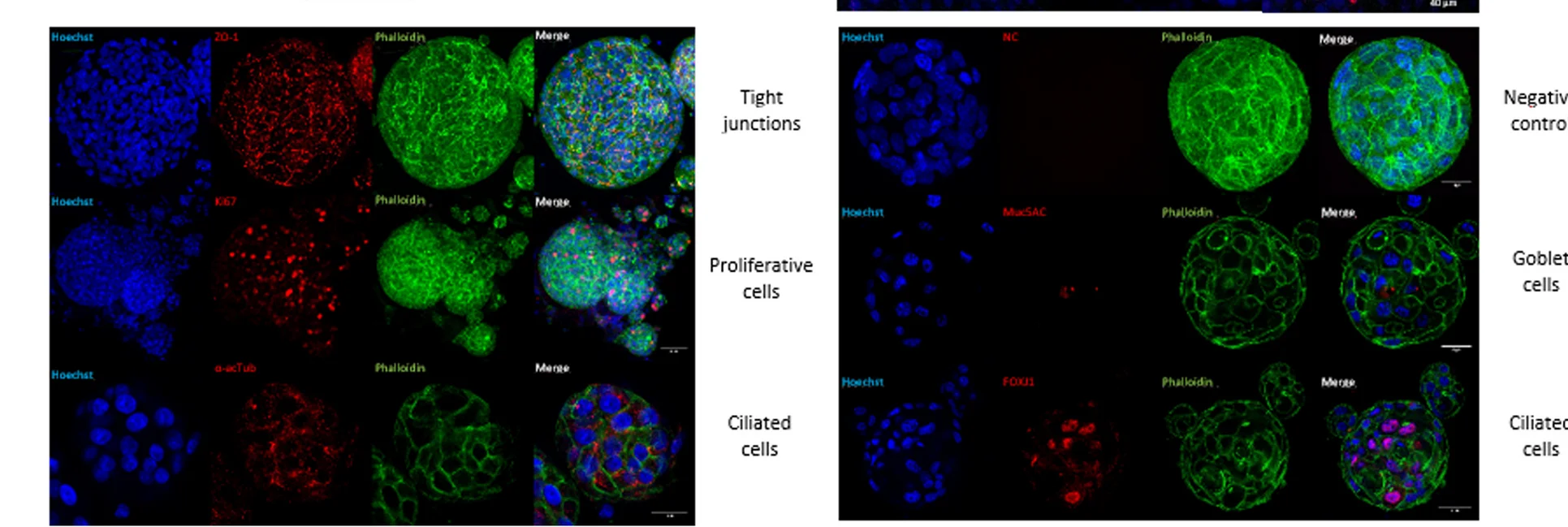 Open access visualization of Microscopy, Cell Marker Expression, PFA-Fixed Differentiated 3D PNOs, Immunofluorescent Assay, ZO-1 Protein