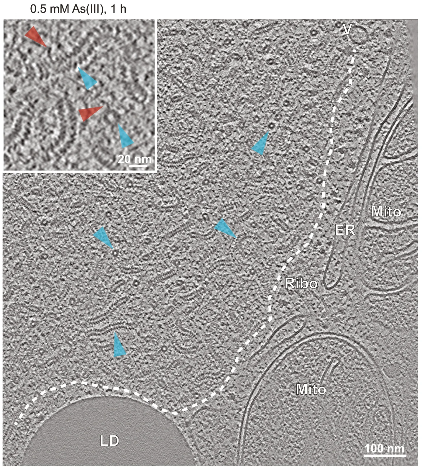 Plot showing: Microscopy, Tomographic Slice, 3D Segmentation, Nucleocapsids, Lipid Droplet
