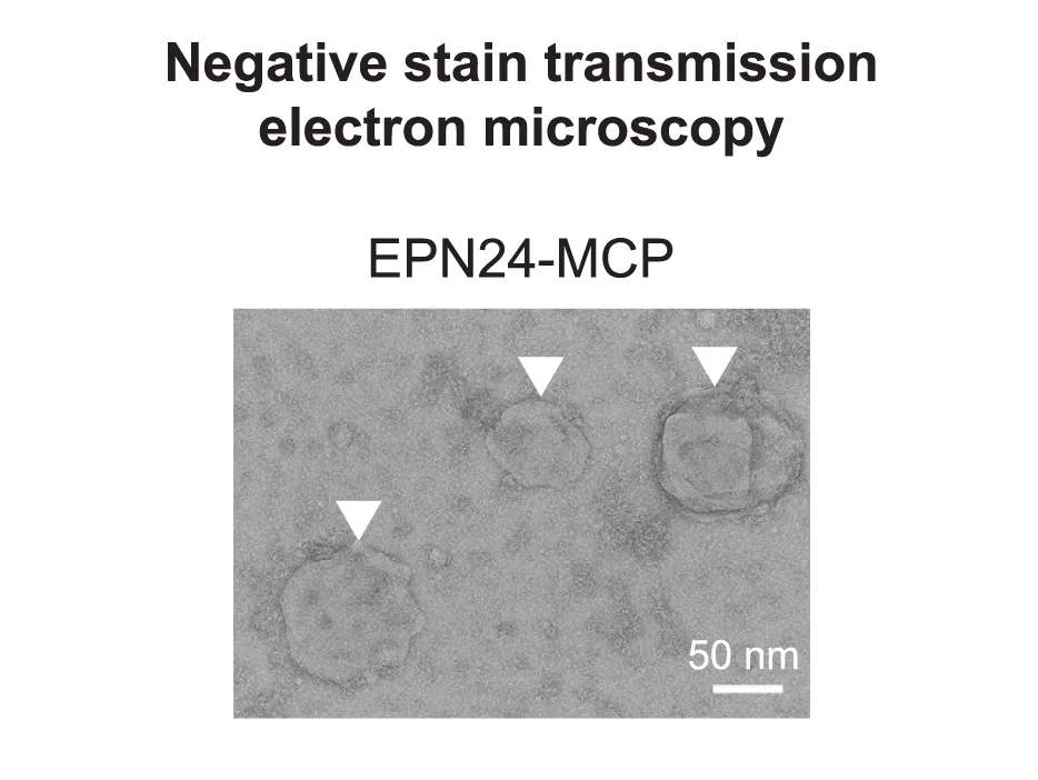 Plot showing: Microscopy, Cells, EPN24-MCP, Vesicle, Electron Microscopy