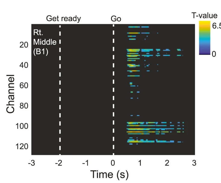 Plot showing: Heatmap, Spatiotemporal Cluster Correction Image, HERPs, ERP, T-test