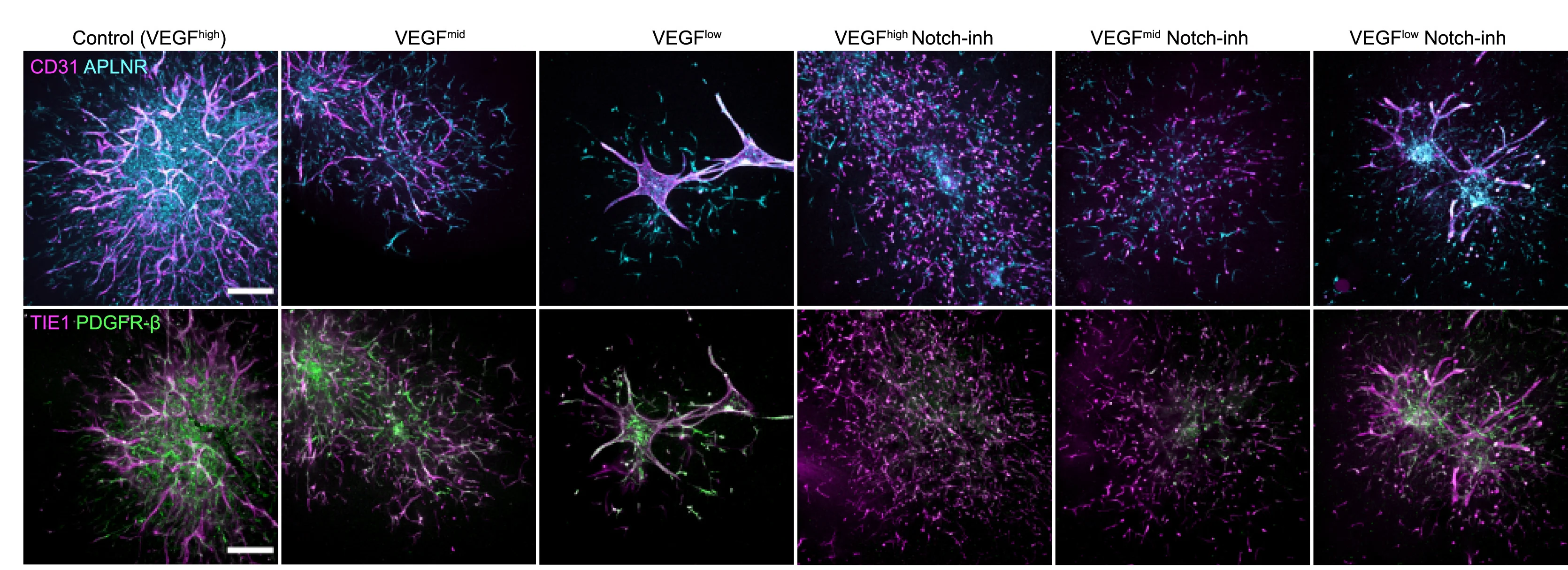 Plot showing: Microscopy, Immunohistochemical Staining, CD31, APLNR, TIE-1