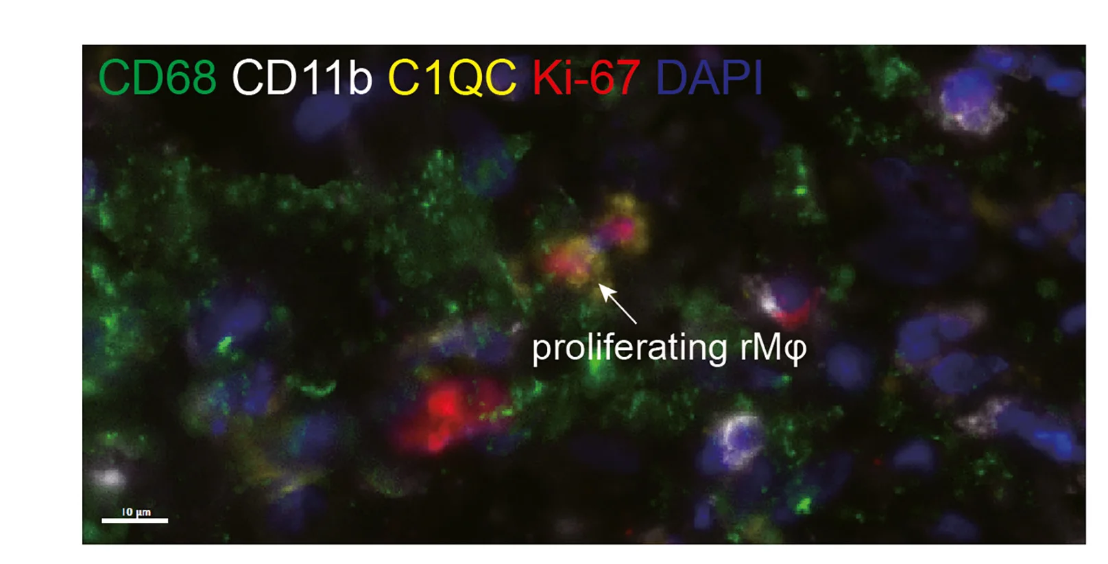 Plot showing: Microscopy, Proliferating rMφ, mIHC, CD68, CD11b