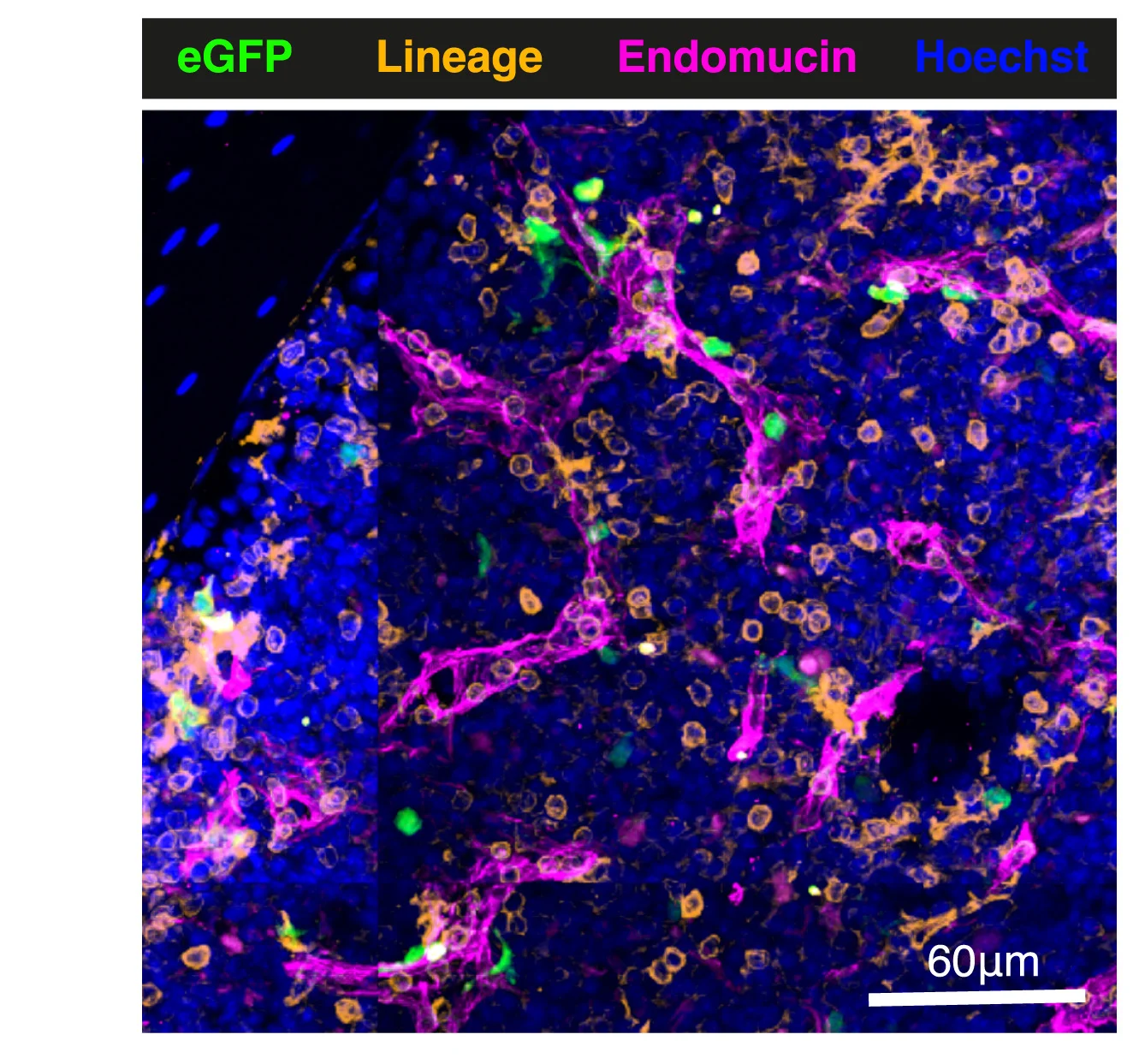 Plot showing: Microscopy, Tibia Cryosection, Endomucin, Lineage Markers, Hoechst