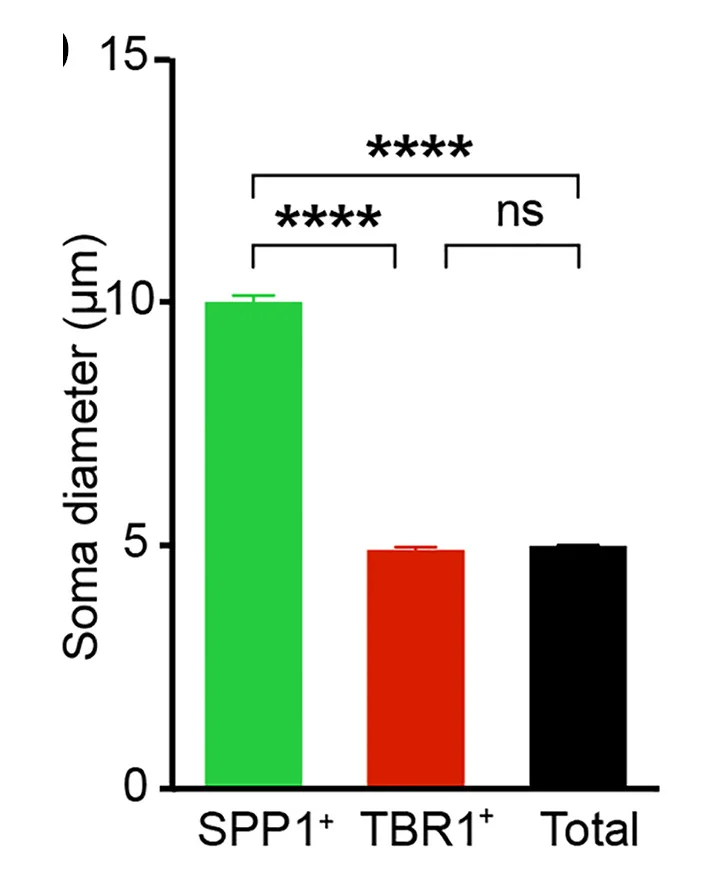 Plot showing: Bar Plot, Error Bars, RGC, Soma Size, SPP1