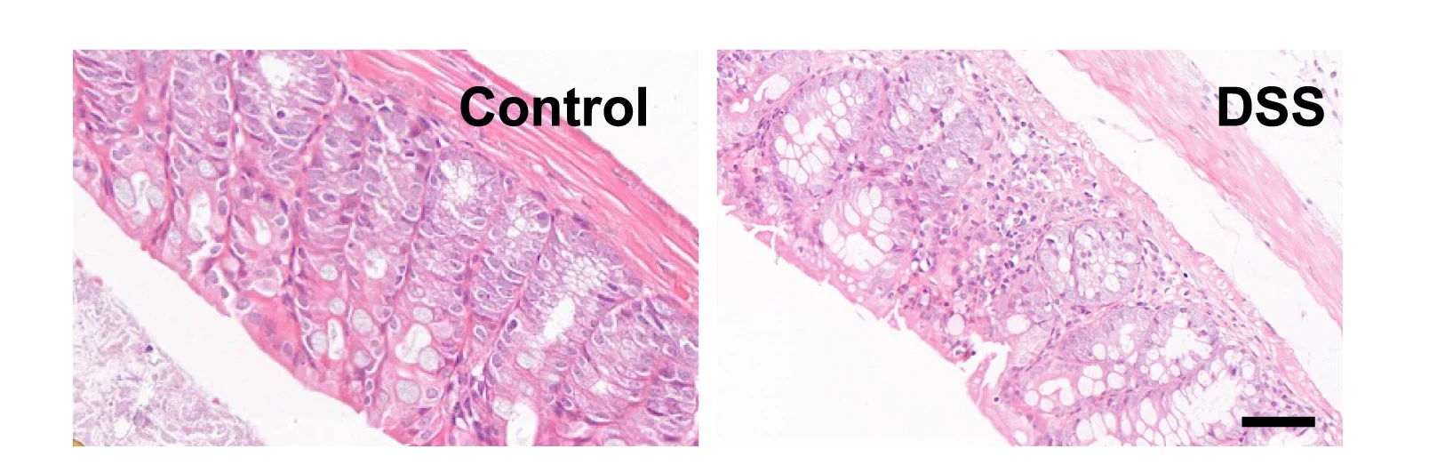 Plot showing: Microscopy, H&E Staining, Colon Tissues, Control Mice, Chronic Colitis Mice