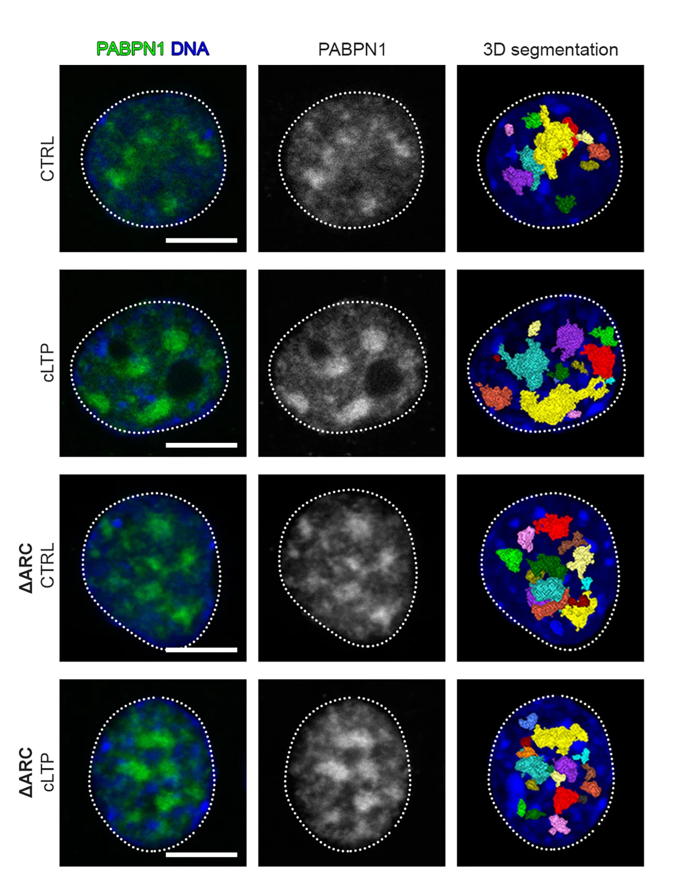 Plot showing: Microscopy, Neuronal Nuclei, Confocal Images, PABPN1, DNA