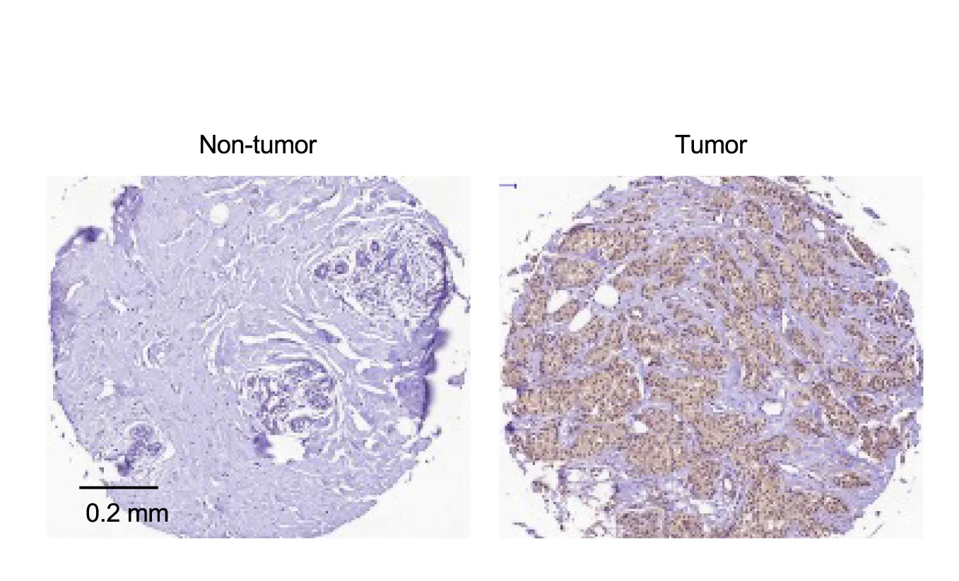 Plot showing: Microscopy, KIF2C Staining, Tumor Sections, Non-Tumor Sections