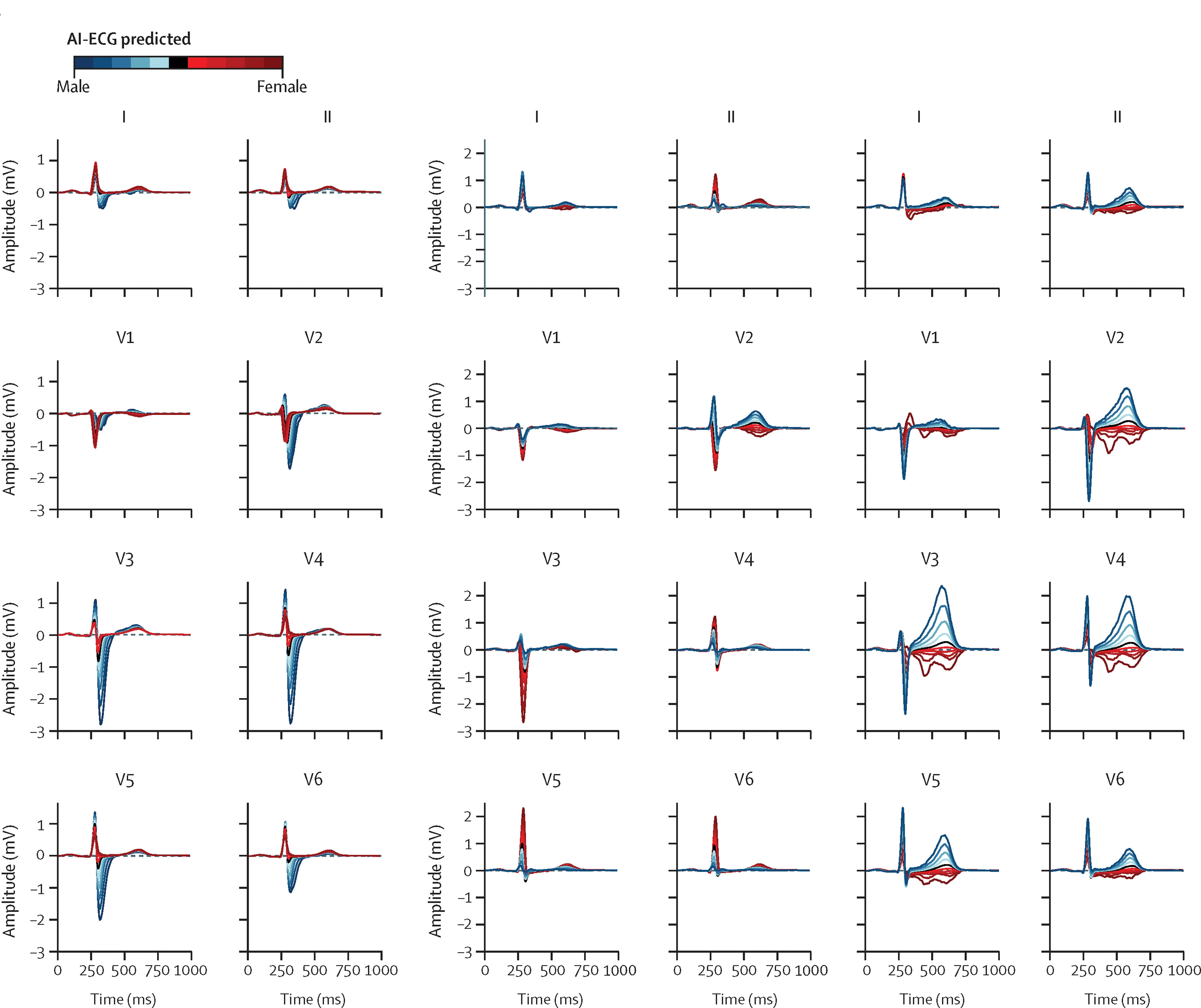 Plot showing: Line Plot, Variational Autoencoder, Morphological Features, AI-ECG, Sex Prediction