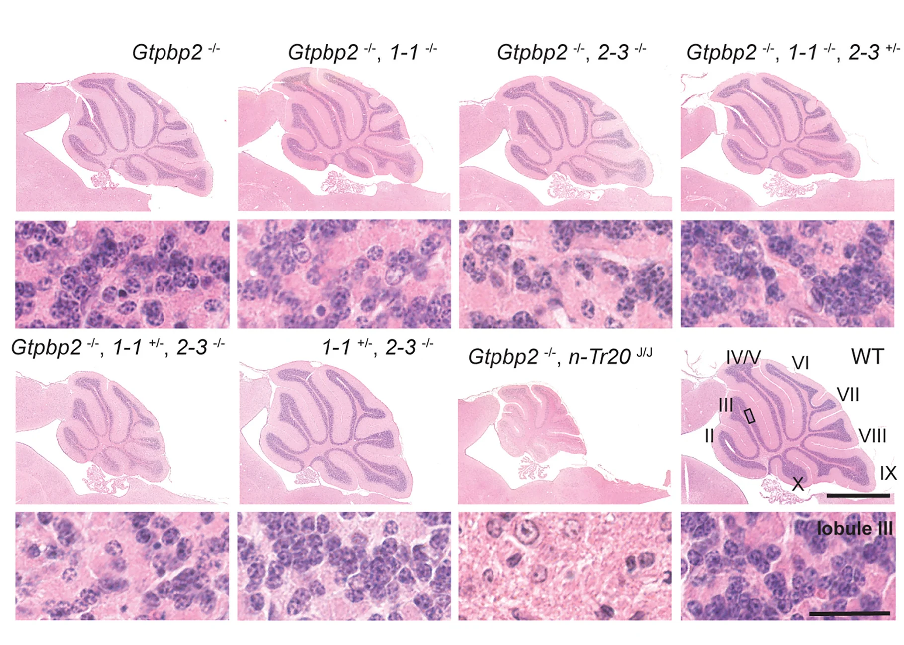Plot showing: Microscopy, tRNAIle(TAT) Pool, Gtpbp2 Loss, Cerebellar Granule Cell, Degeneration