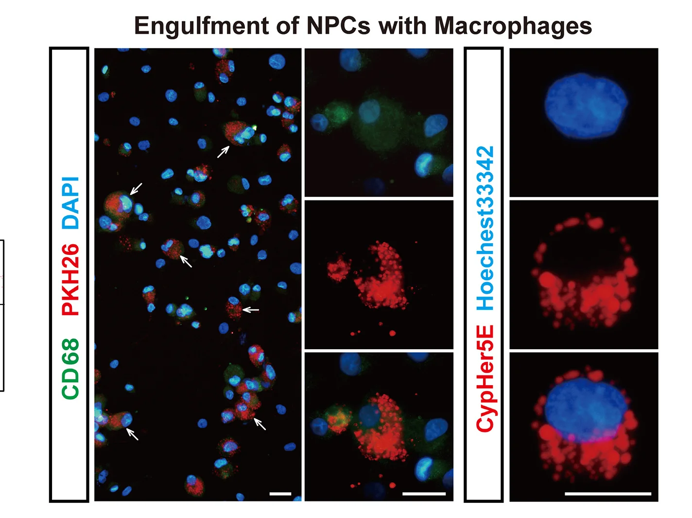 Plot showing: Microscopy, CD68 Staining, Hoechest33342, TDMs, PKH26