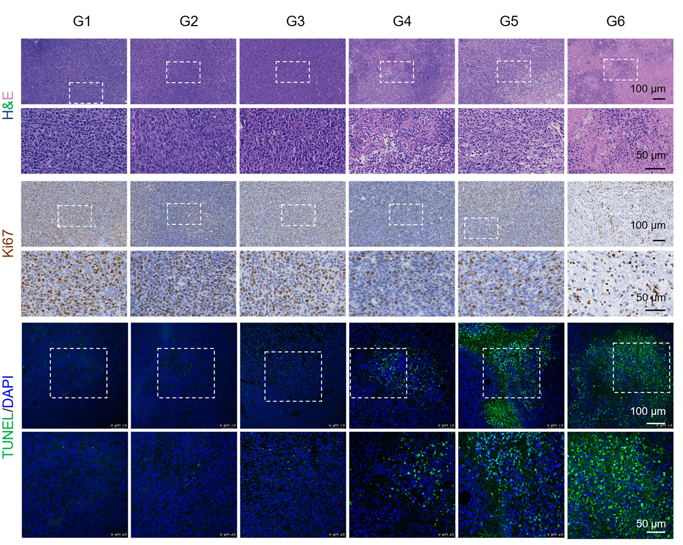 Plot showing: Microscopy, H&E Staining, Ki67 Staining, TUNEL Staining, Tumor Sections