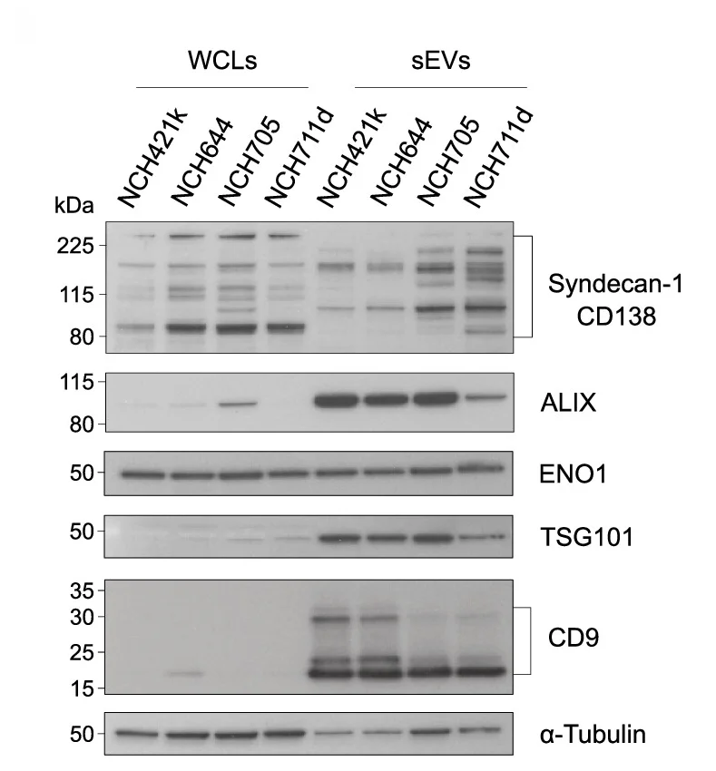 Plot showing: Gel, Western Blot, Whole-cell Lysates, sEVs, EV Markers