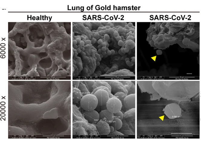 Plot showing: Microscopy, SEM Images, Golden Hamster, Lung Tissues, SARS-CoV-2