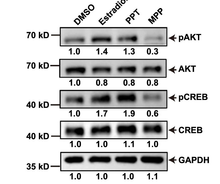 Plot showing: Gel, Immunoblotting, Phosphorylated AKT, Total AKT, Phosphorylated CREB