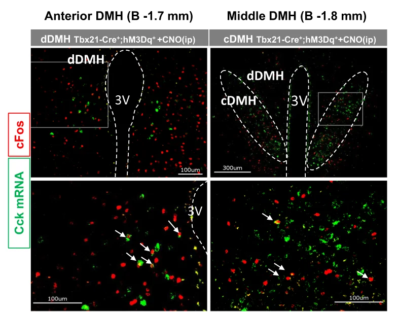 Plot showing: Microscopy, Immunohistochemistry, In Situ Hybridization, Cck, cFos Protein