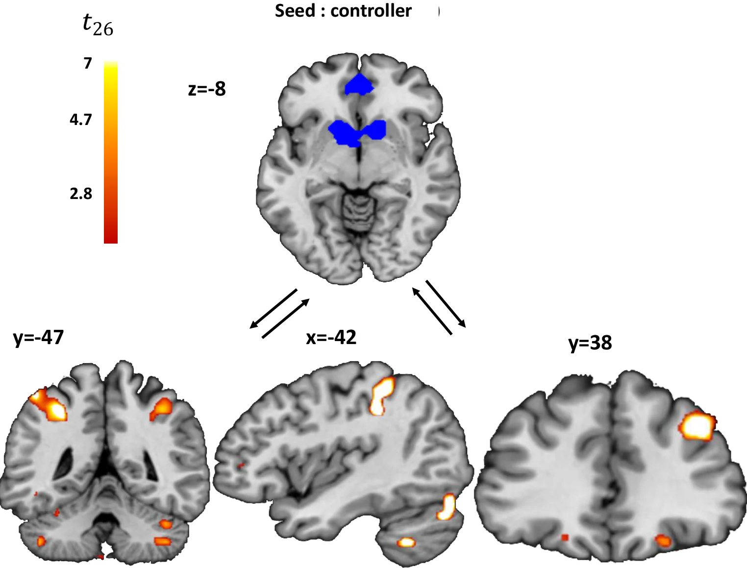 Plot showing: Heatmap, Connectivity Analysis, BOLD Signal, Seed Regions, mPFC