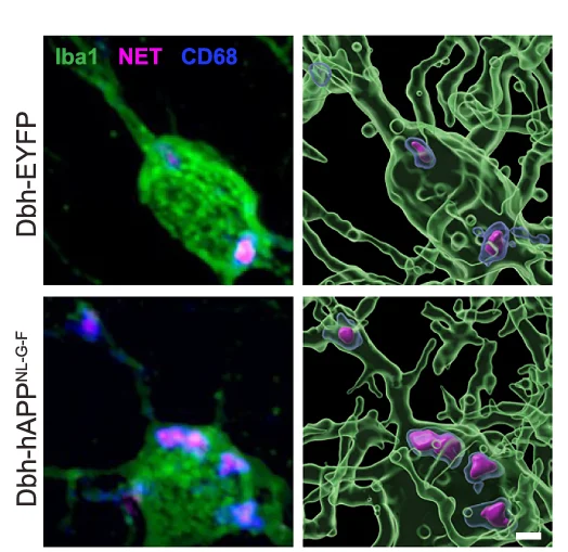 Plot showing: Microscopy, Immunostaining, 3D Reconstruction, Microglia, Lysosomes