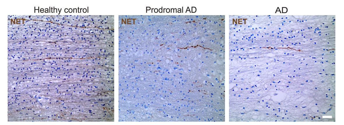 Plot showing: Microscopy, Immunohistochemical Staining, Brain Sections, Axons