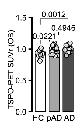 Plot showing: Bar Plot, Scatter Plot, TSPO Signal, Brain Donors, Alzheimer's Disease