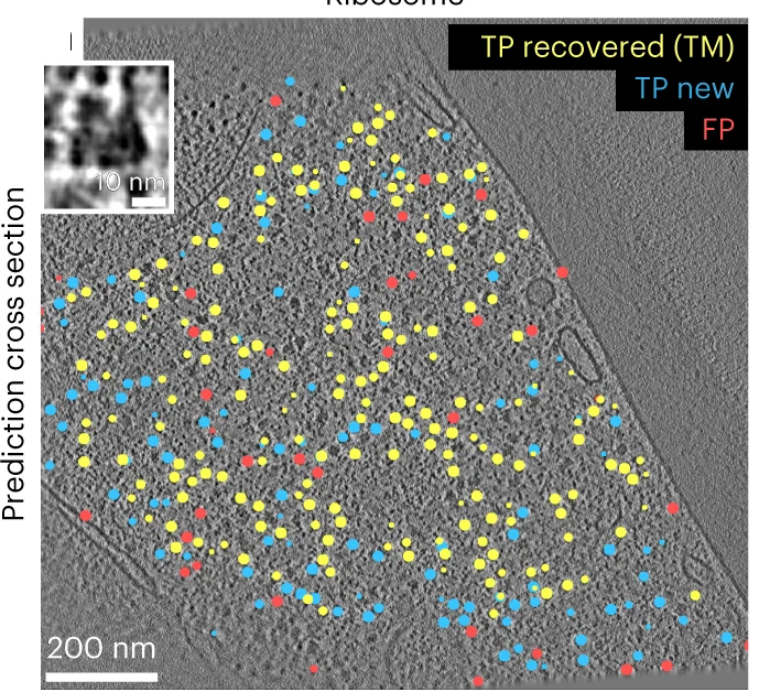 Plot showing: Microscopy, Ribosomes, DeePiCt, Tomographic Slice, True Positives