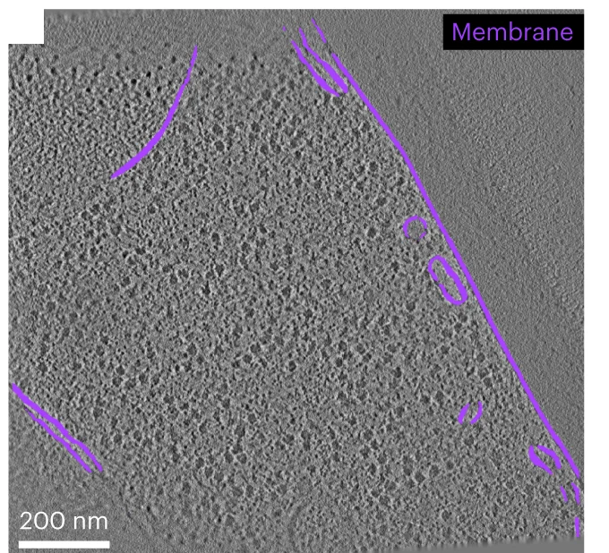 Plot showing: Microscopy, Membranes, DeePiCt, Tomographic Slice