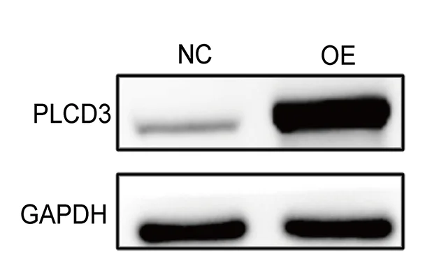 Plot showing: Gel, Tumor Cell Proliferation, Tumor Cell Migration, Tumor Cell Invasion