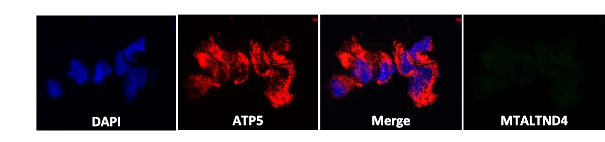 Plot showing: Microscopy, MTALTND4, ATP5, Immunofluorescence, HeLa cells