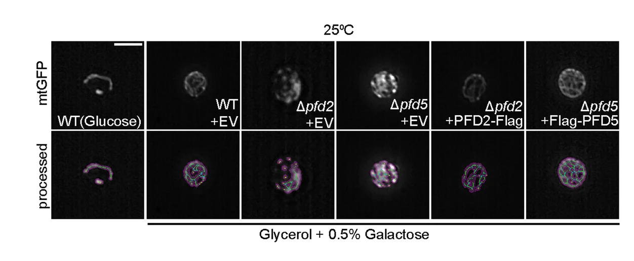 Plot showing: Microscopy, Yeast Cells, Mitochondria, GFP, Glycerol