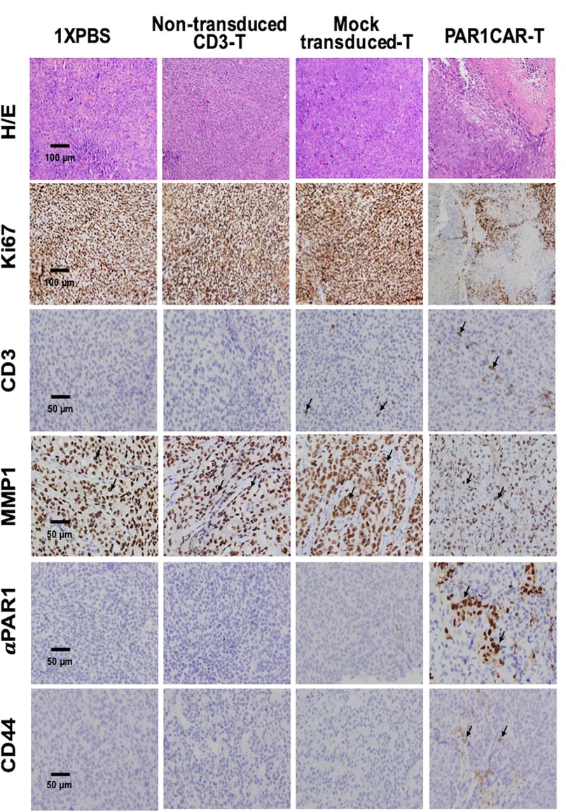 Plot showing: Microscopy, Tumor Sections, Hematoxylin and Eosin Staining, Ki67, CD3