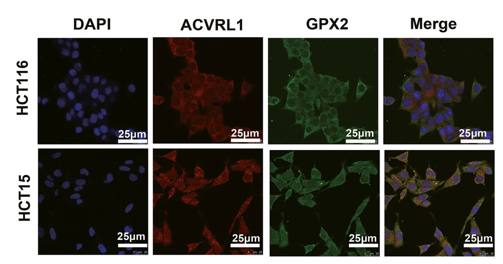 Plot showing: Microscopy, Immunofluorescence, ACVRL1, GPX2, HCT15 Cells