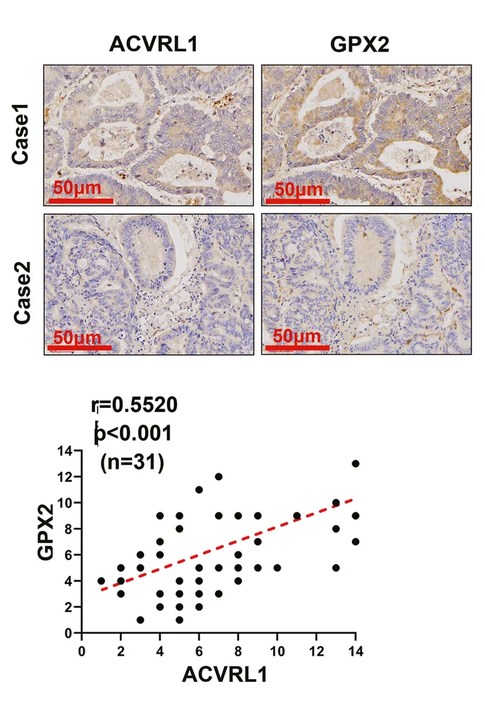 Plot showing: Microscopy, Scatter Plot, Regression Plot, Immunohistochemistry, ACVRL1