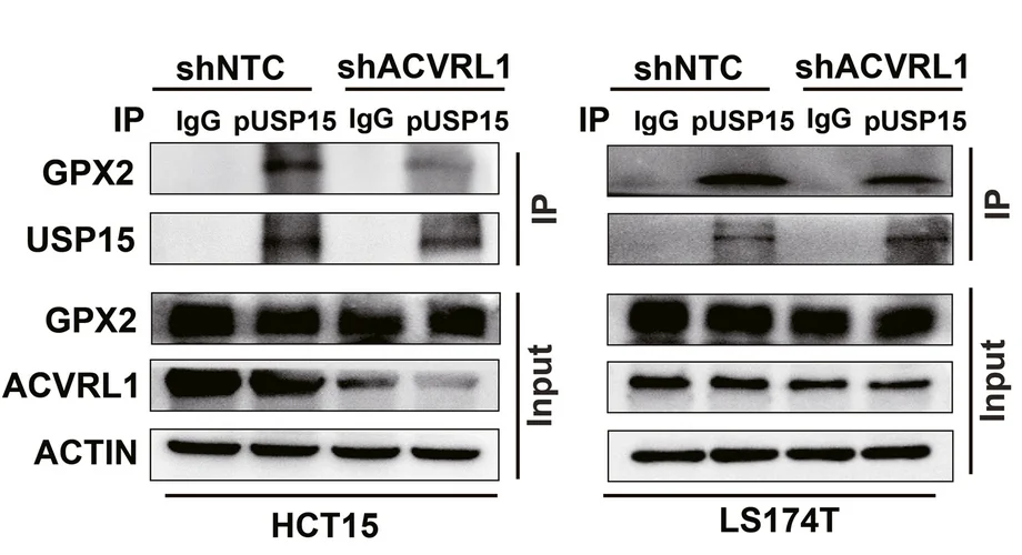 Plot showing: Gel, Western Blot, GPX2, USP15, CRC Cells