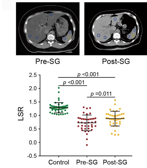 Plot showing: Scatter Plot, Error Bars, CT Scan, LSR, Control Group